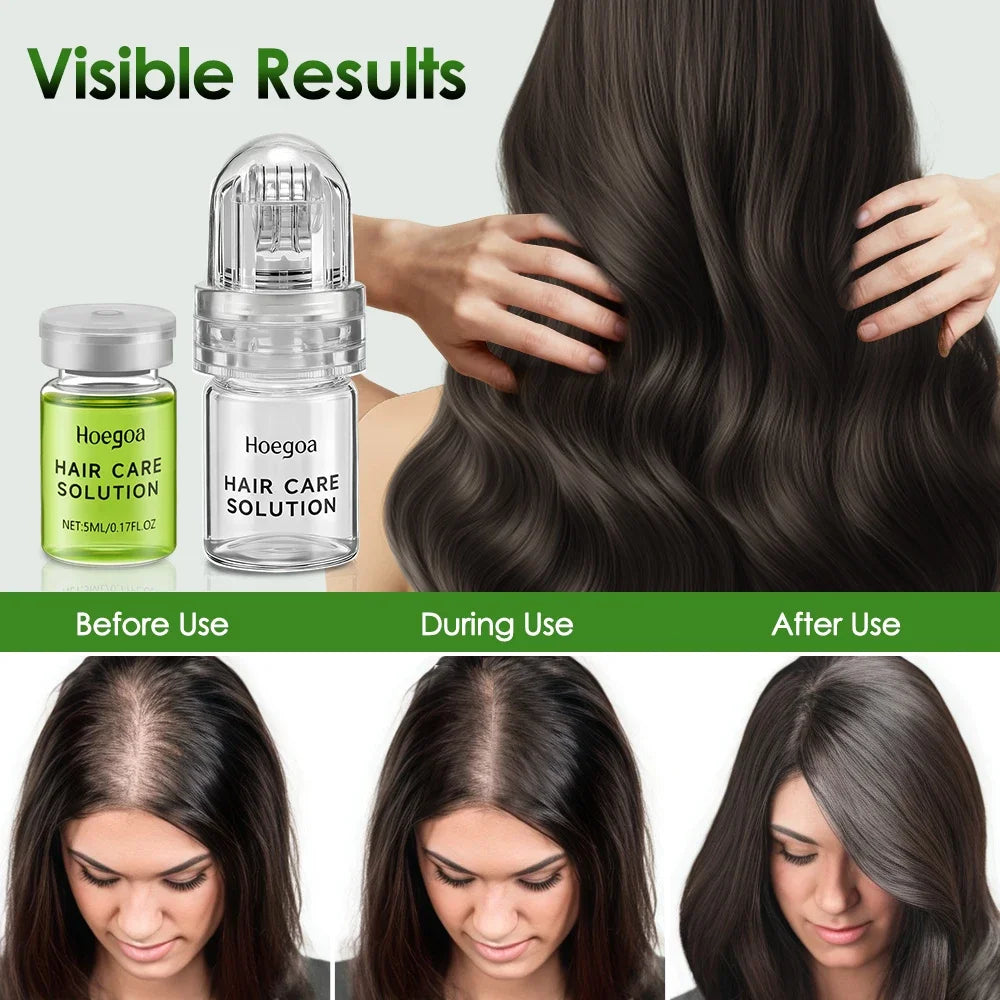 Hair Growth Serum Scalp Care Strengthening Nourishing Anti-Hair Loss